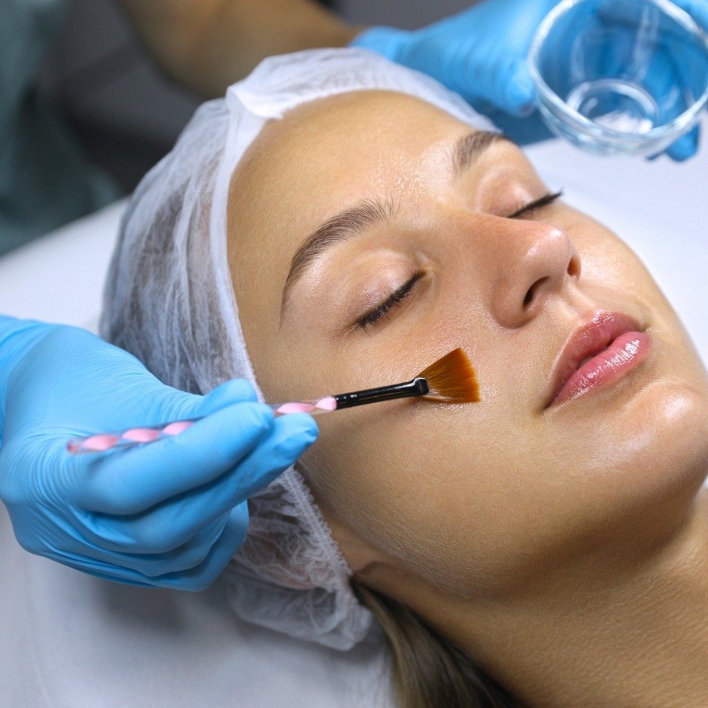 Customized Medical Chemical Peels