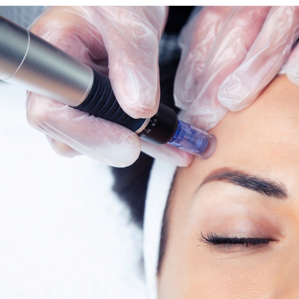 Dermapen Microneedling & Collagen Induction